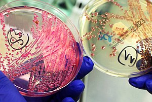 Baktériu E.coli preniesla na potraviny nakazená osoba